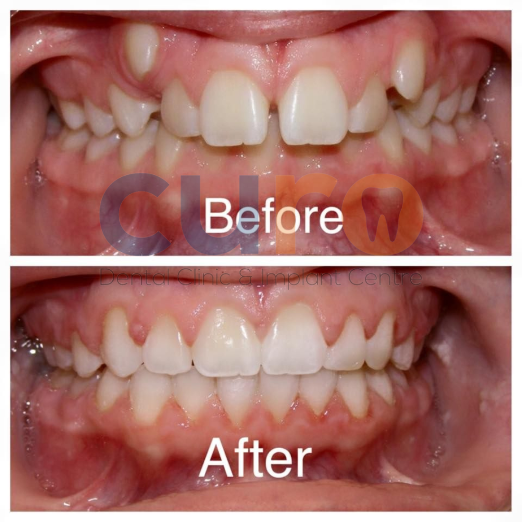 orthodontic-curo-dental-ravet